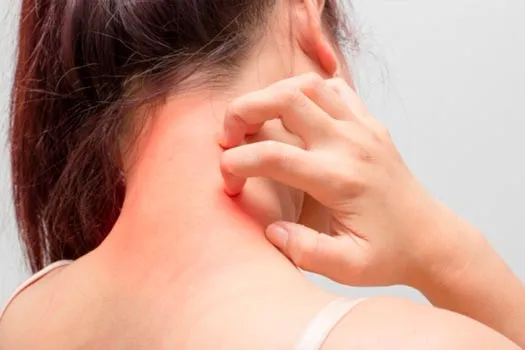 Prurido na DRC: passo a passo prático que funciona