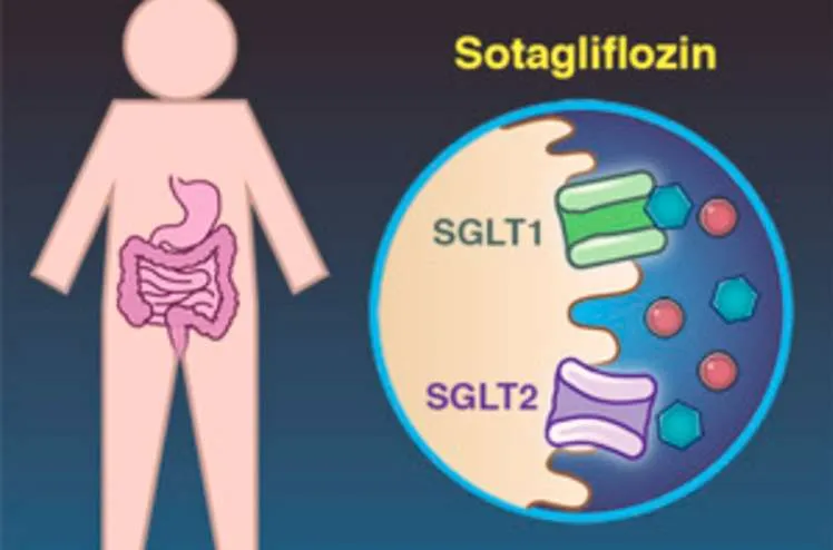Uso do Sotagliflozina em Hipomagnesemia Refratária: Um Caso Clínico Relevante