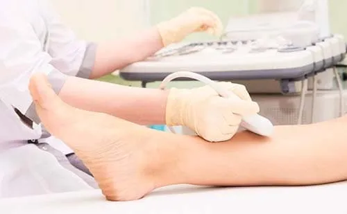 Como tratar tromboembolismo venoso na DRC