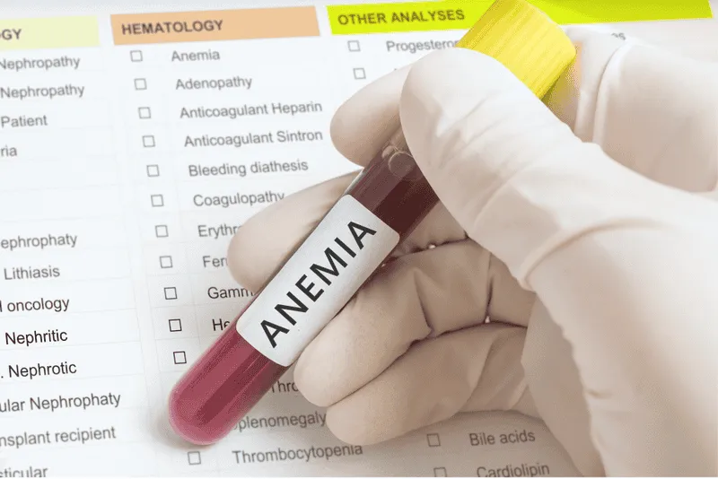 KDIGO de Anemias (2024): Tratamento da Ferropenia