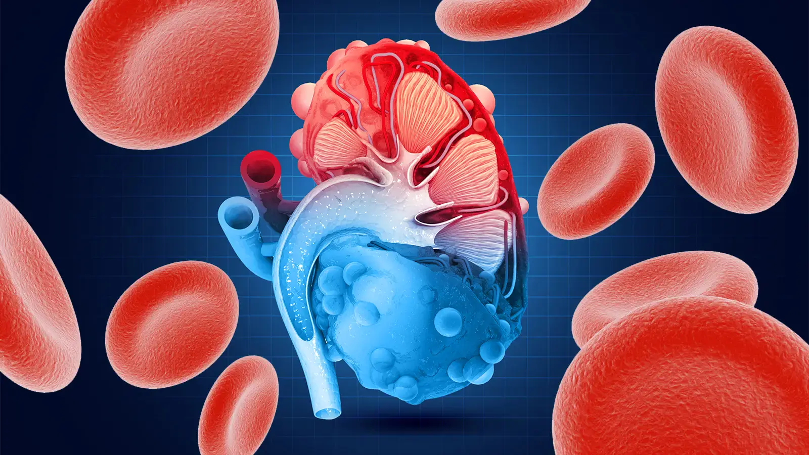 KDIGO anemia 2024: manejo prático dos agentes estimuladores da eritropoiese