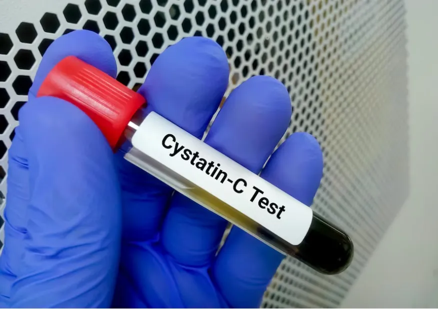 Discordância entre Creatinina e Cistatina C e o risco de eventos adversos 