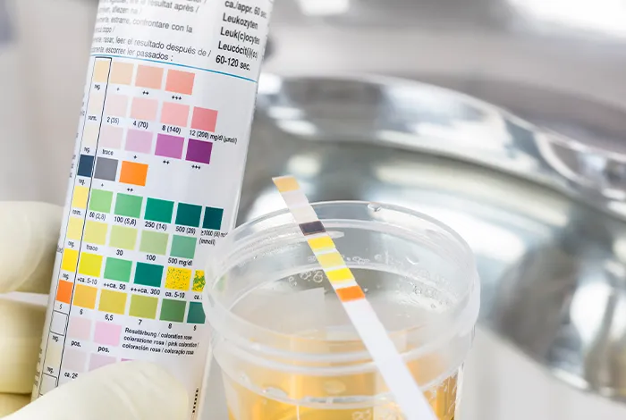 Novos insights sobre doença renal do diabetes: Não esqueça desses conceitos para sua prática!