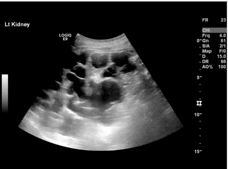 KDIGO DRPAD (2025): Diagnóstico e Prognóstico