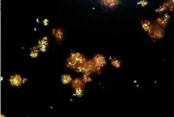 IRA associada ao tratamento para pneumocistose?