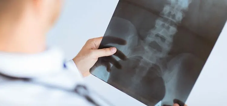 Vasculite e diálise, atenção especial ao risco de fraturas!