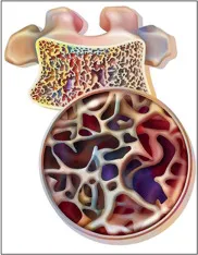 10 dicas práticas para avaliar a saúde óssea do paciente com DRC (parte 1)