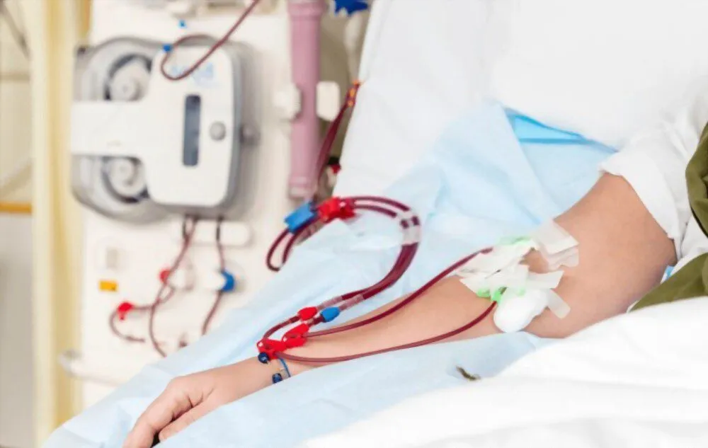 Diálise incremental: existe a possibilidade de HD duas vezes por semana?