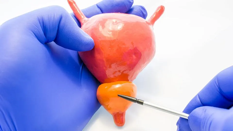 HPB e LUTS: quando e como tratar, quando encaminhar? 