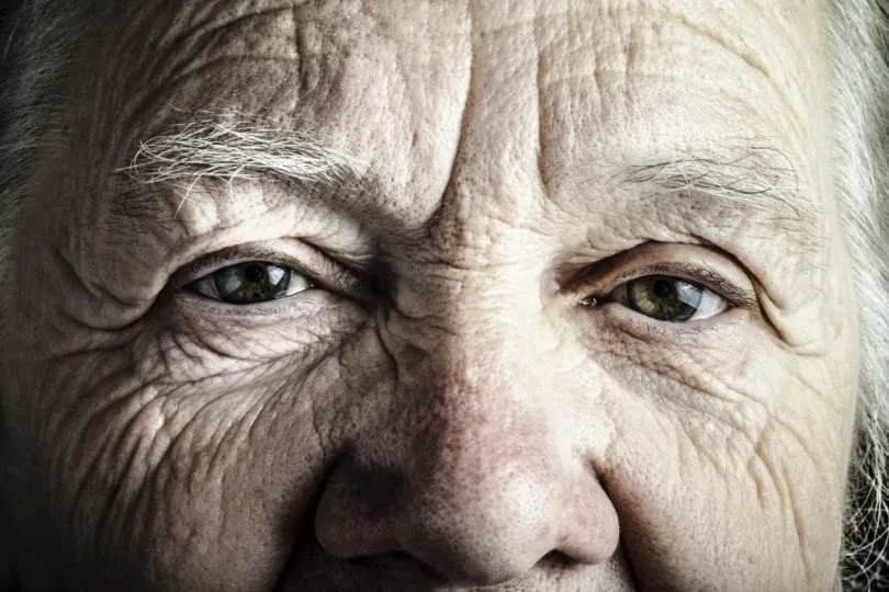 Glomerulopatias em idosos frágeis: até onde devemos ir com a imunossupressão?