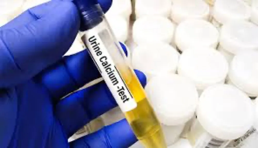 Você sabe mesmo como interpretar a hipercalciúria?