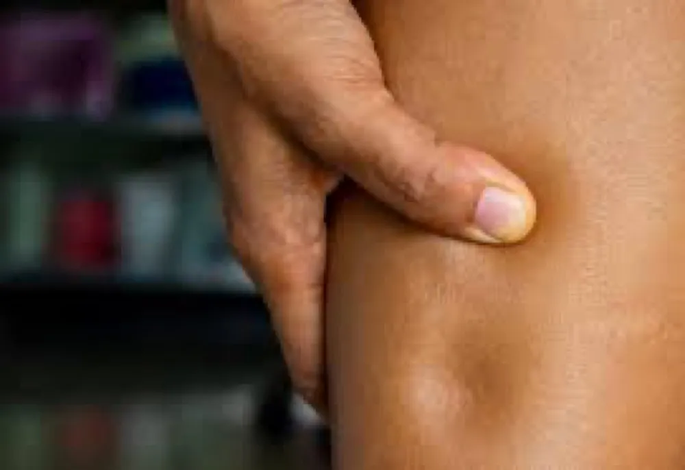 Glomerulopatia sem biópsia renal, devemos iniciar corticoide?