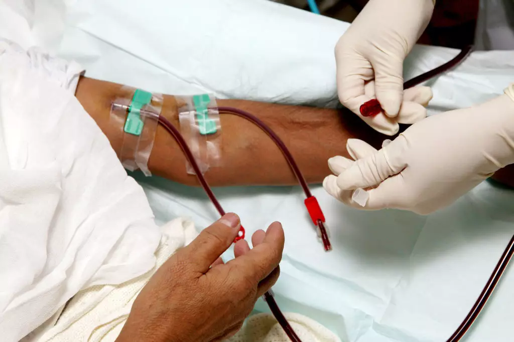 Anemia na diálise: Foco nos Estoque de Ferro