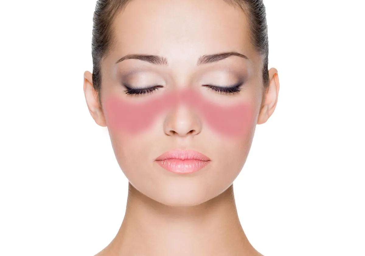 Obinutuzumabe no Tratamento da Nefrite Lúpica: Um Novo Caminho?