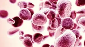 Como Identificar Proteínas Monoclonais na Prática Clínica (parte 1)