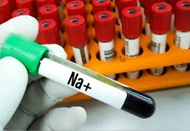 Sódio do dialisato, existe um número mágico?