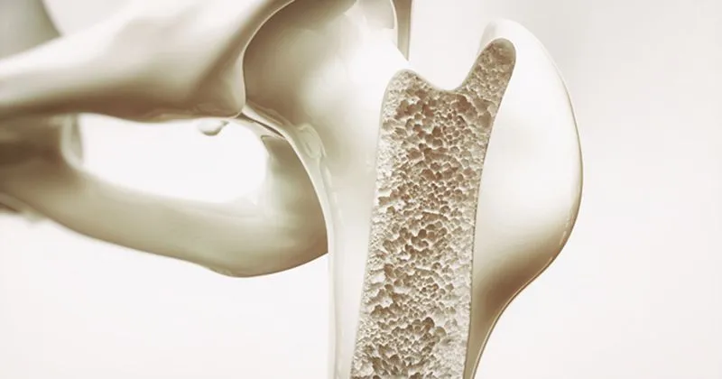 10 dicas práticas para avaliar a saúde óssea do paciente com DRC (parte 2)