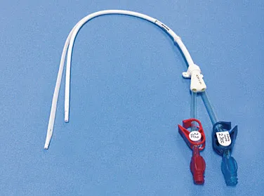 Lockterapia no Tratamento de Infecções de Cateter de Hemodiálise