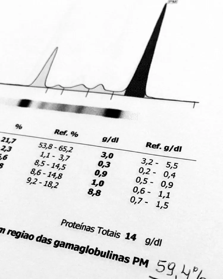 Como Identificar Proteínas Monoclonais na Prática Clínica (parte 2)