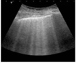  O paciente está congesto? O que realmente ajuda na prática?