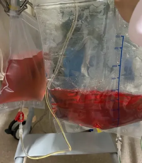 Efluente vermelho na Contínua, nem sempre é sangue!