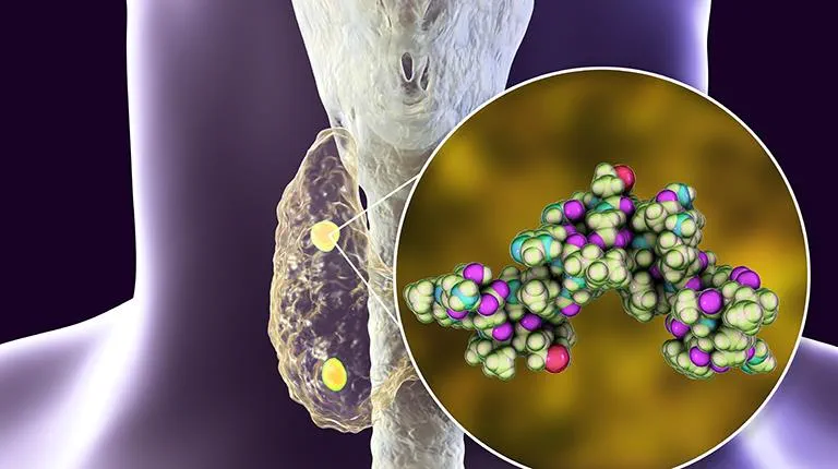 Manejo prático do tratamento da DMO nos pacientes em diálise