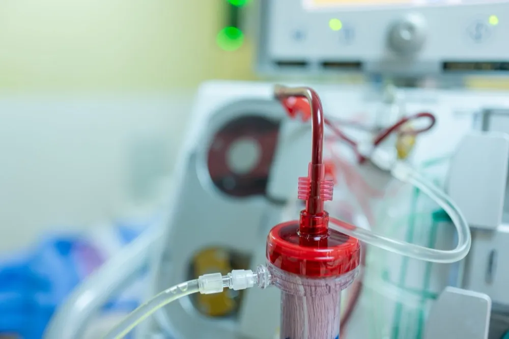 Otimizando a ultrafiltração em pacientes anúricos com choque séptico