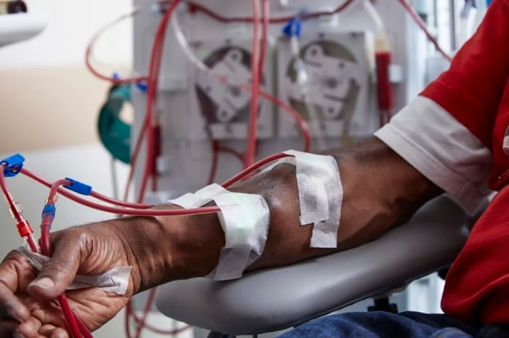 Acesso arteriovenoso para a hemodiálise