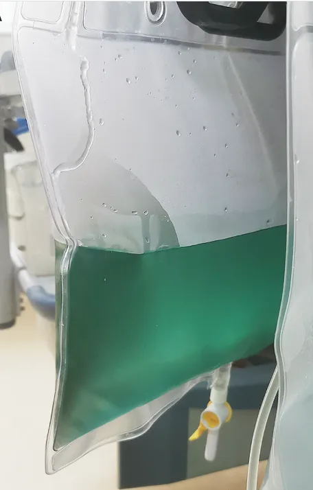 Efluente do dialisato verde?