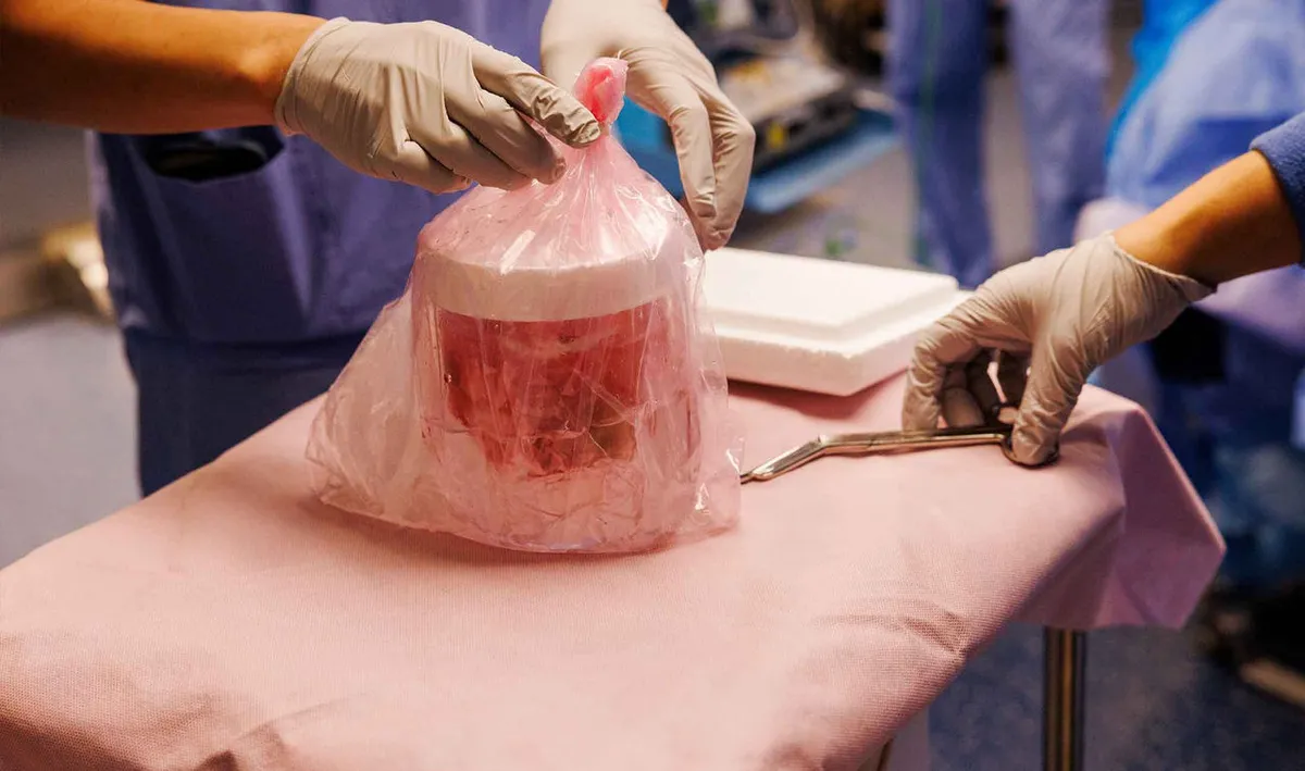 Xenotransplante Renal: um marco no Transplante!